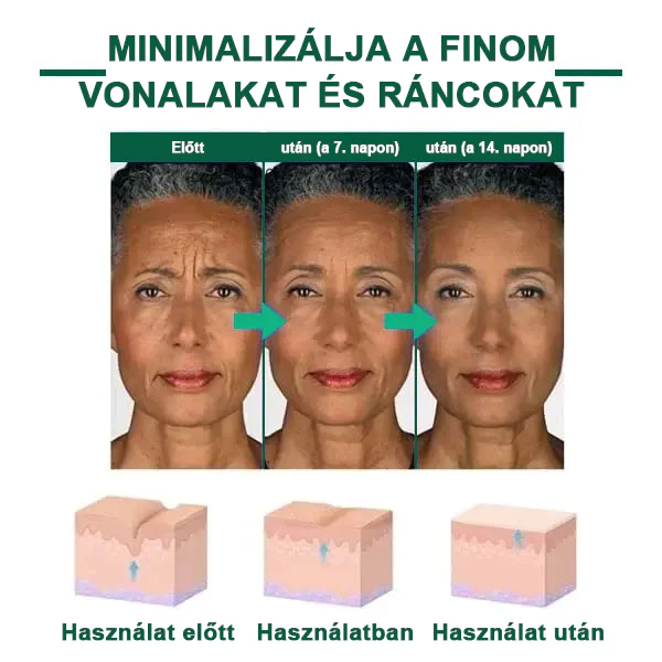 FirmSkin - Firmador de pele