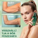 FirmSkin - Firmador de pele