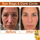 RevitaLift - Revitalizador dos olhos