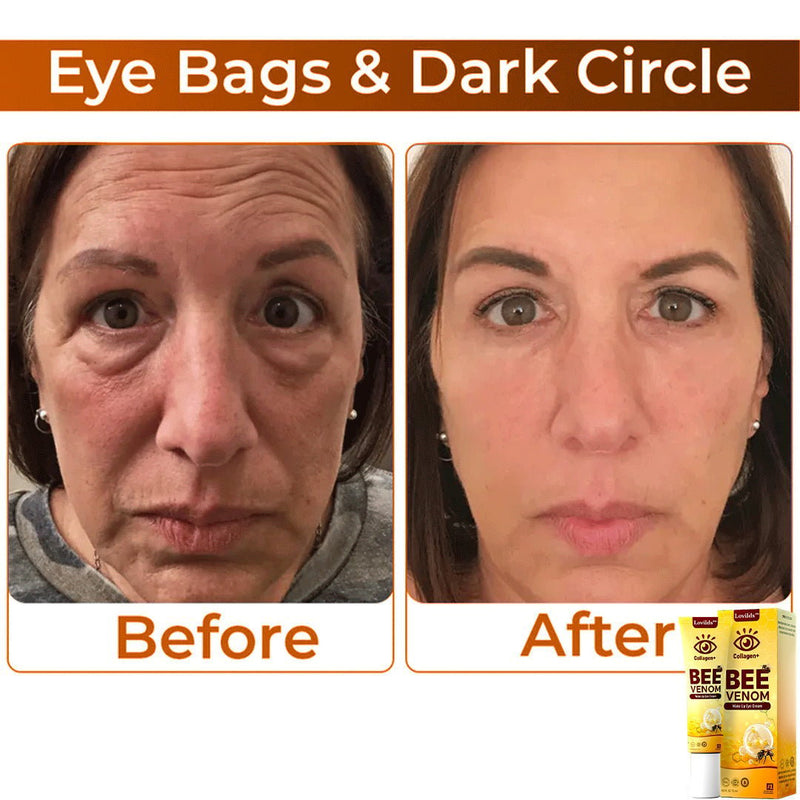 RevitaLift - Revitalizador dos olhos