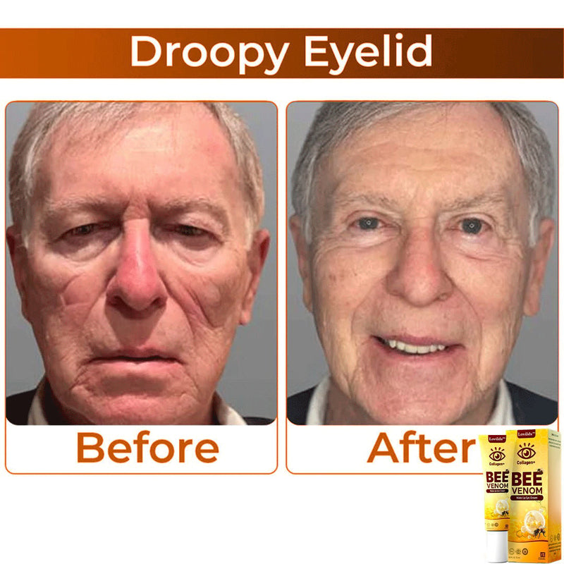 RevitaLift - Revitalizador dos olhos