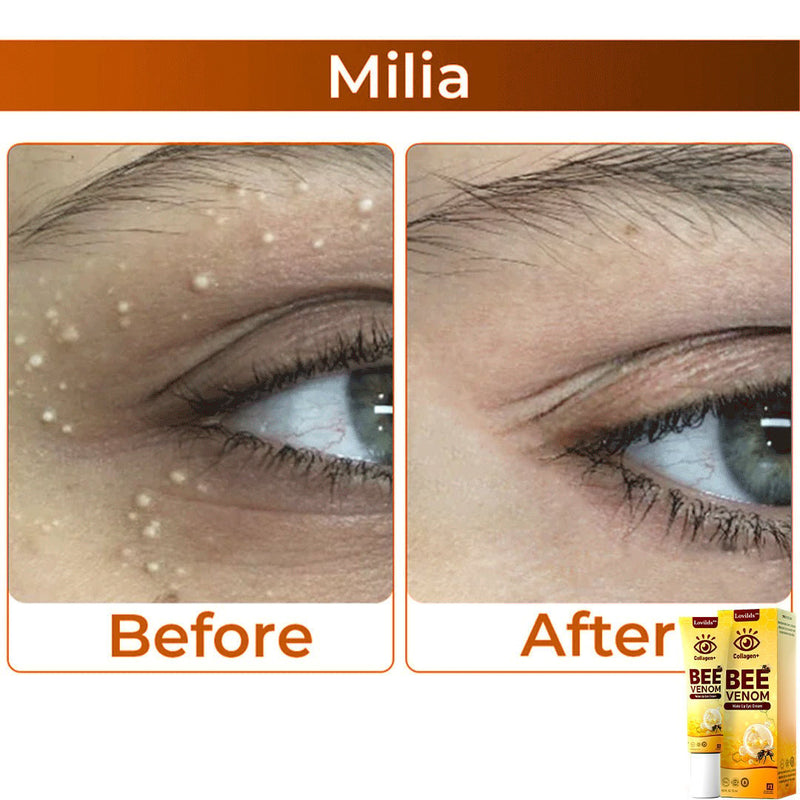 RevitaLift - Revitalizador dos olhos