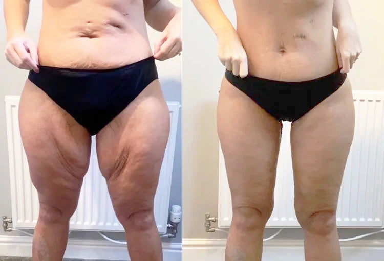 Solenne Collagen -  Firmador de Pele