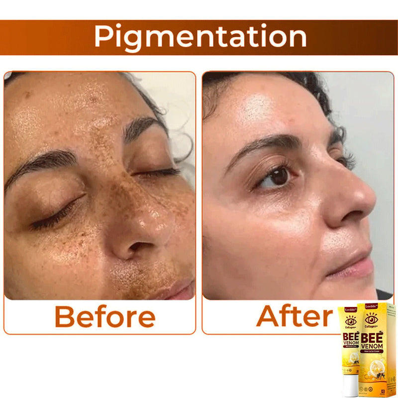 RevitaLift - Revitalizador dos olhos