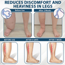 ByeBye Inchaço - Creme Desintoxicante