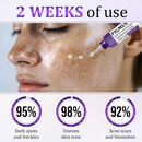 PigmentaX ProFade - Anti-hiperpigmentação