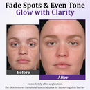 PigmentaX ProFade - Anti-hiperpigmentação