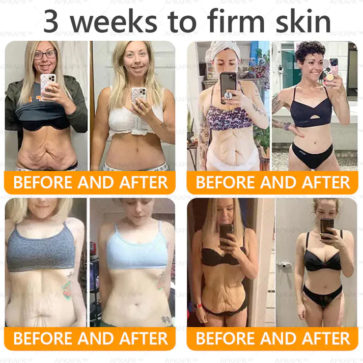 Royal Venom Cream | Firmador de pele