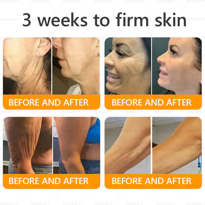 Royal Venom Cream | Firmador de pele