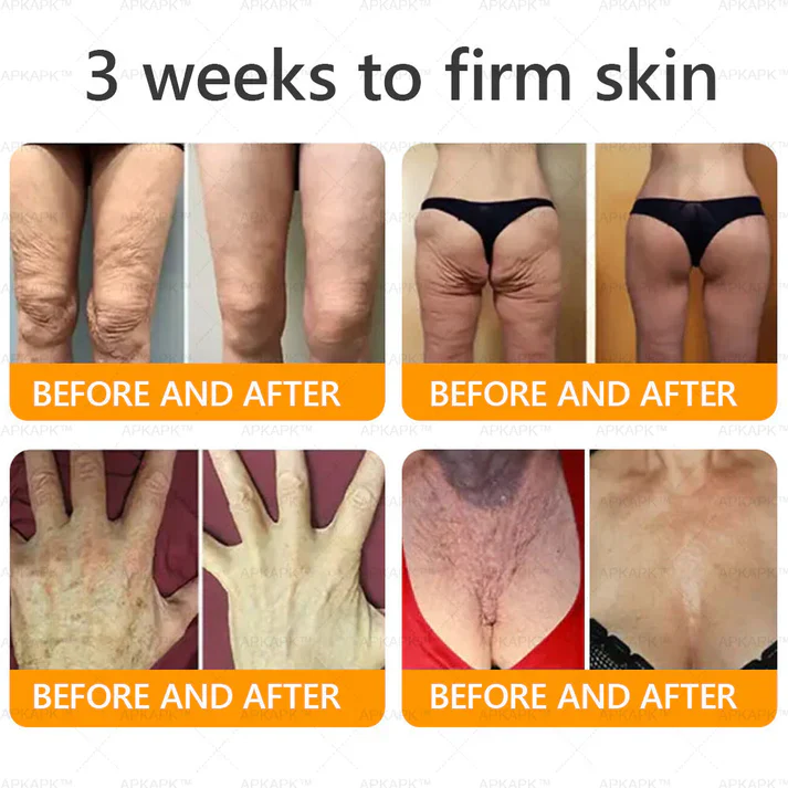 Royal Venom Cream | Firmador de pele