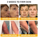 MelLift - Creme Antienvelhecimento