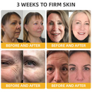 MelLift - Creme Antienvelhecimento