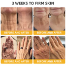 MelLift - Creme Antienvelhecimento