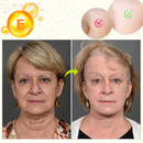 RevitaBoost- Soro Facial