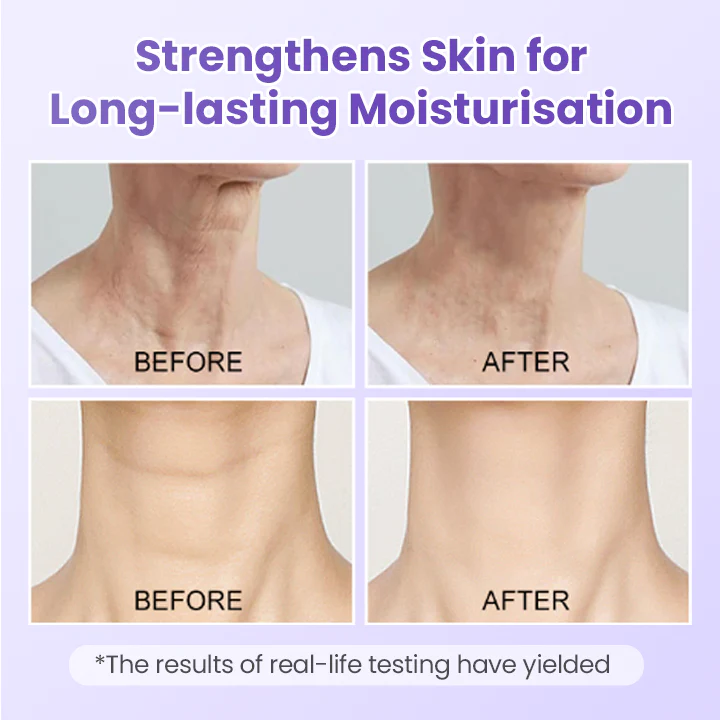 Adeus Papada Patch - Adesivo Antirrugas Para Pescoço