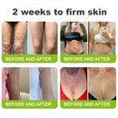 Sérum Shot De Botox