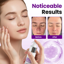 Sérum Probiótico SpotErase