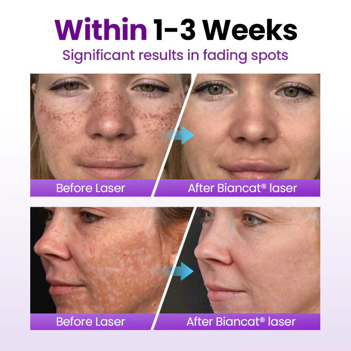 Sérum Probiótico SpotErase