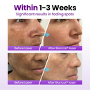 Sérum Probiótico SpotErase