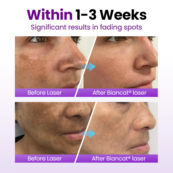 Sérum Probiótico SpotErase