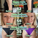 🎄 Promoção de Natal - Sérum Firmador de Células Tronco e Colágeno✨Creme e Hidratante (Firma a pele flácida, reduz rugas, atenua manchas escuras e melhora a elasticidade)