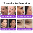 Lifting Rolimey - Creme Firmador  //  Último dia de promoção: 60% de desconto