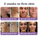 Lifting Rolimey - Creme Firmador  //  Último dia de promoção: 60% de desconto