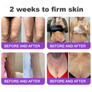 Lifting Rolimey - Creme Firmador  //  Último dia de promoção: 60% de desconto