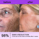 Lifting Rolimey - Creme Firmador  //  Último dia de promoção: 60% de desconto