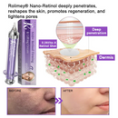 Lifting Rolimey - Creme Firmador  //  Último dia de promoção: 60% de desconto