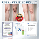 ByeBye Inchaço - Creme Desintoxicante