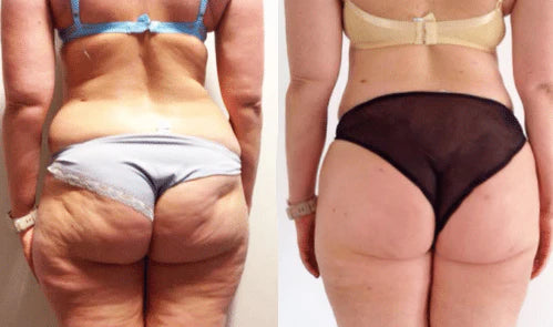 Solenne Collagen -  Firmador de Pele